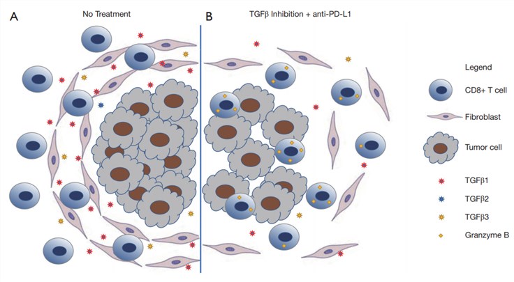 TGF-β inhibition promotes T cell infiltration.