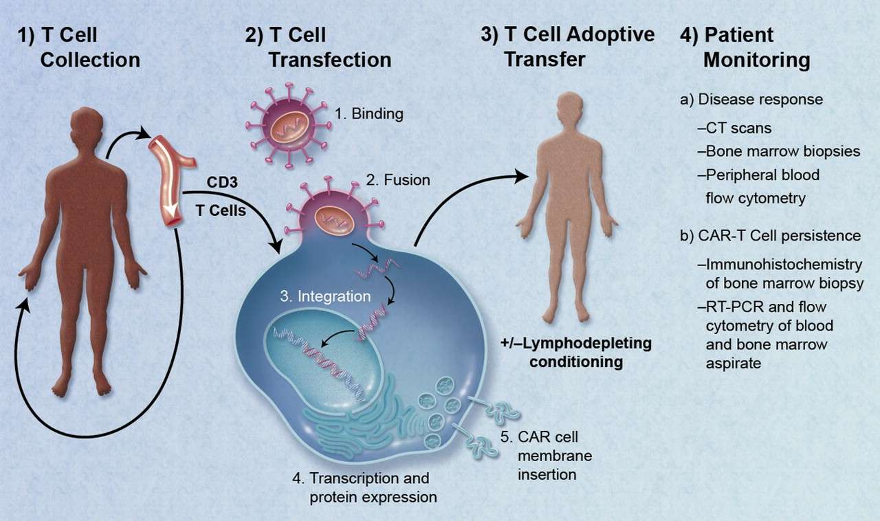 Schematic of the treatment of a patient with CAR T cells. (Jacobson, et al., 2011)