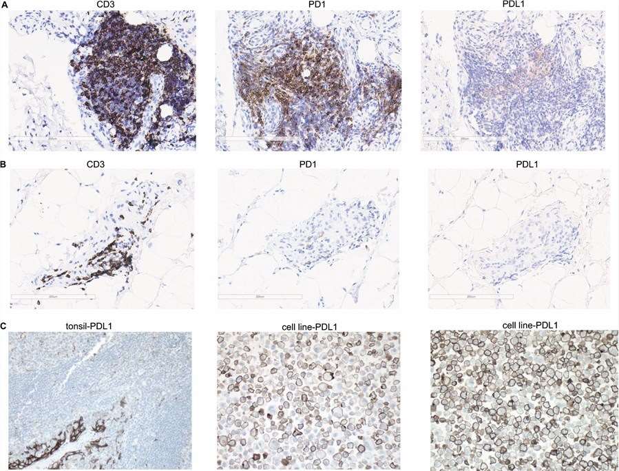 RA and immune checkpoint molecules. (Guo, et al., 2018)