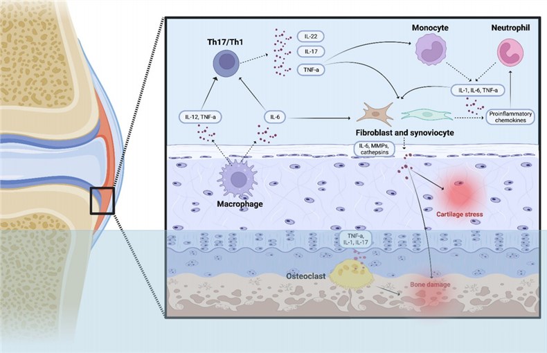 JIA and immune cells. (Bella, et al., 2023)