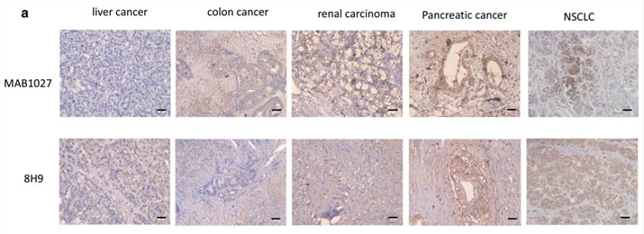 Expression of B7-H3 in human tissues.